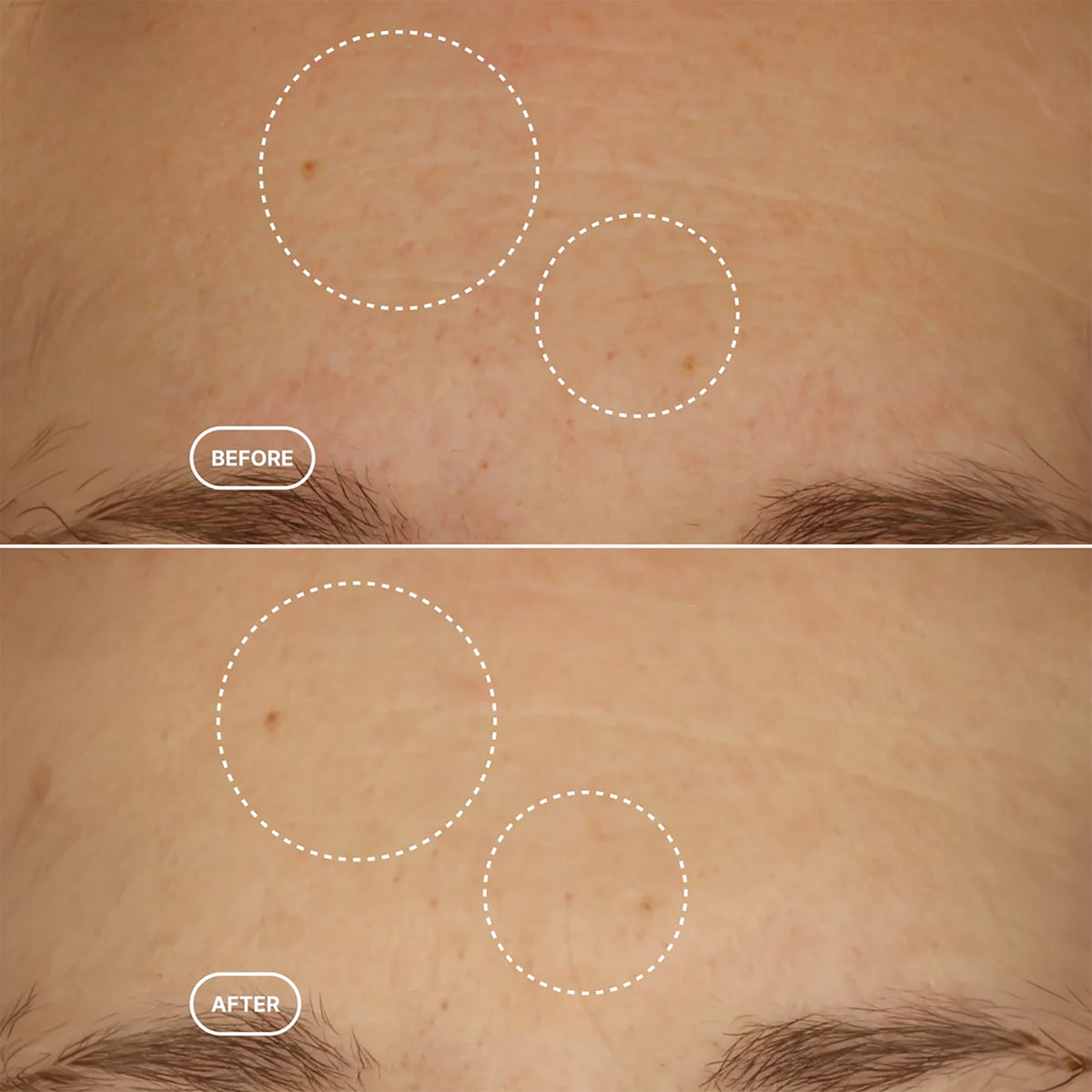 Retinol Alternative Serum - 30ml
