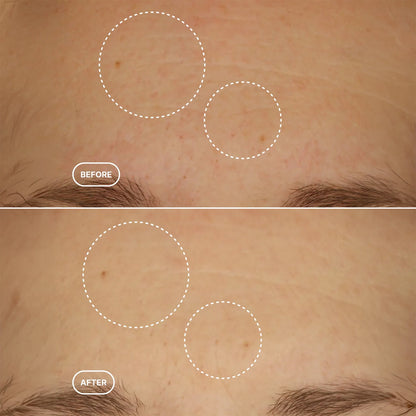 Retinol Alternative Serum - 30ml
